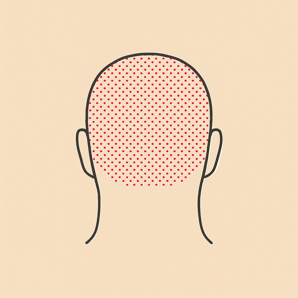 Micropigmentación capilar densidad