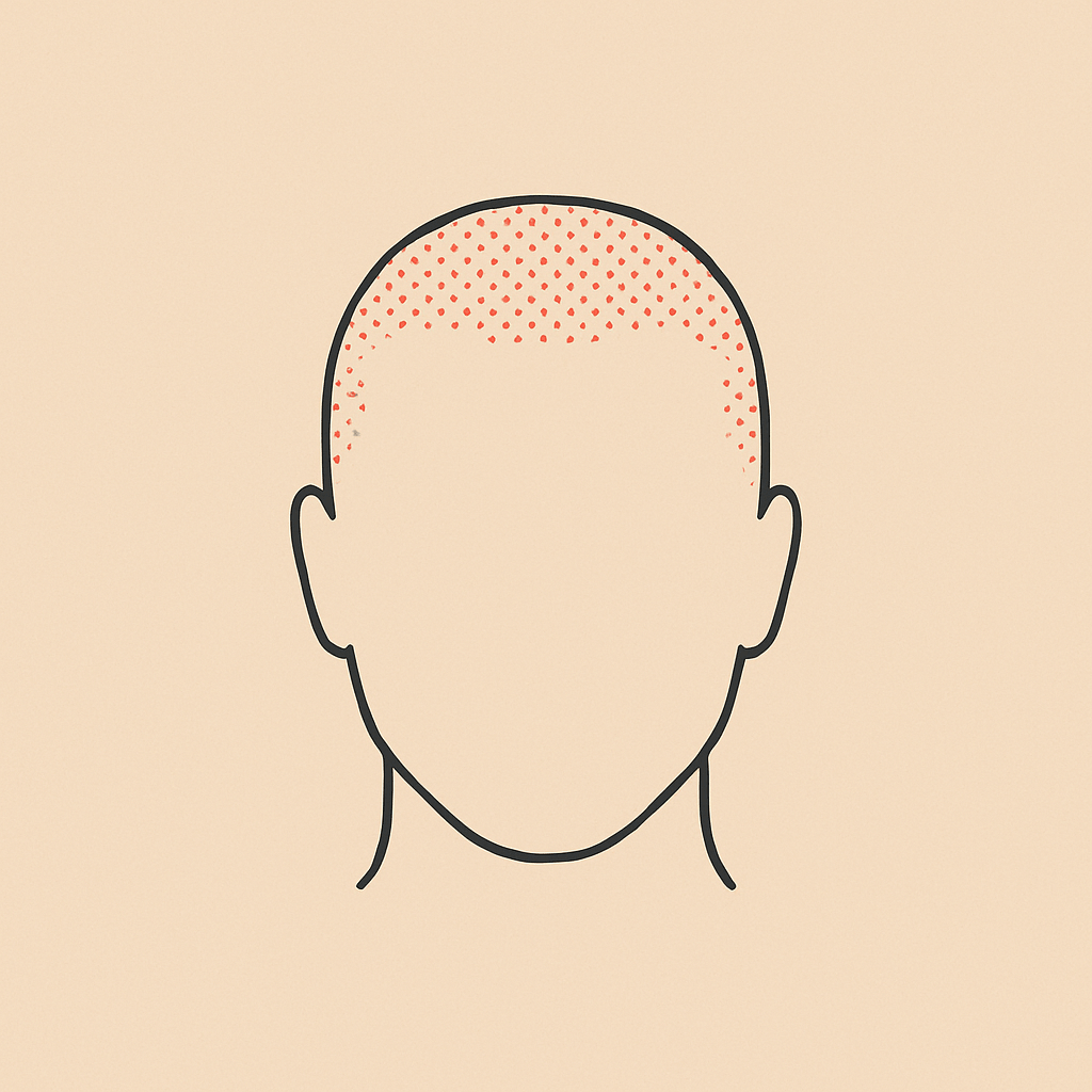 Micropigmentación efecto rapado